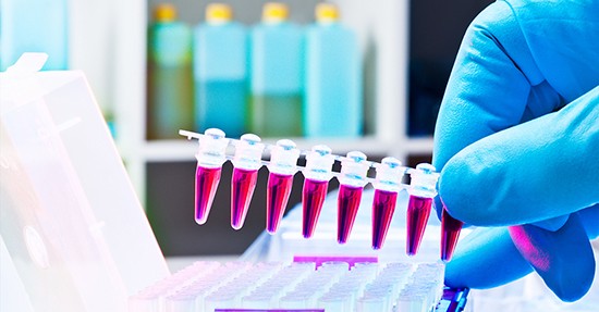 Analyse und Qualitätskontrolle Analyse und Qualitätskontrolle